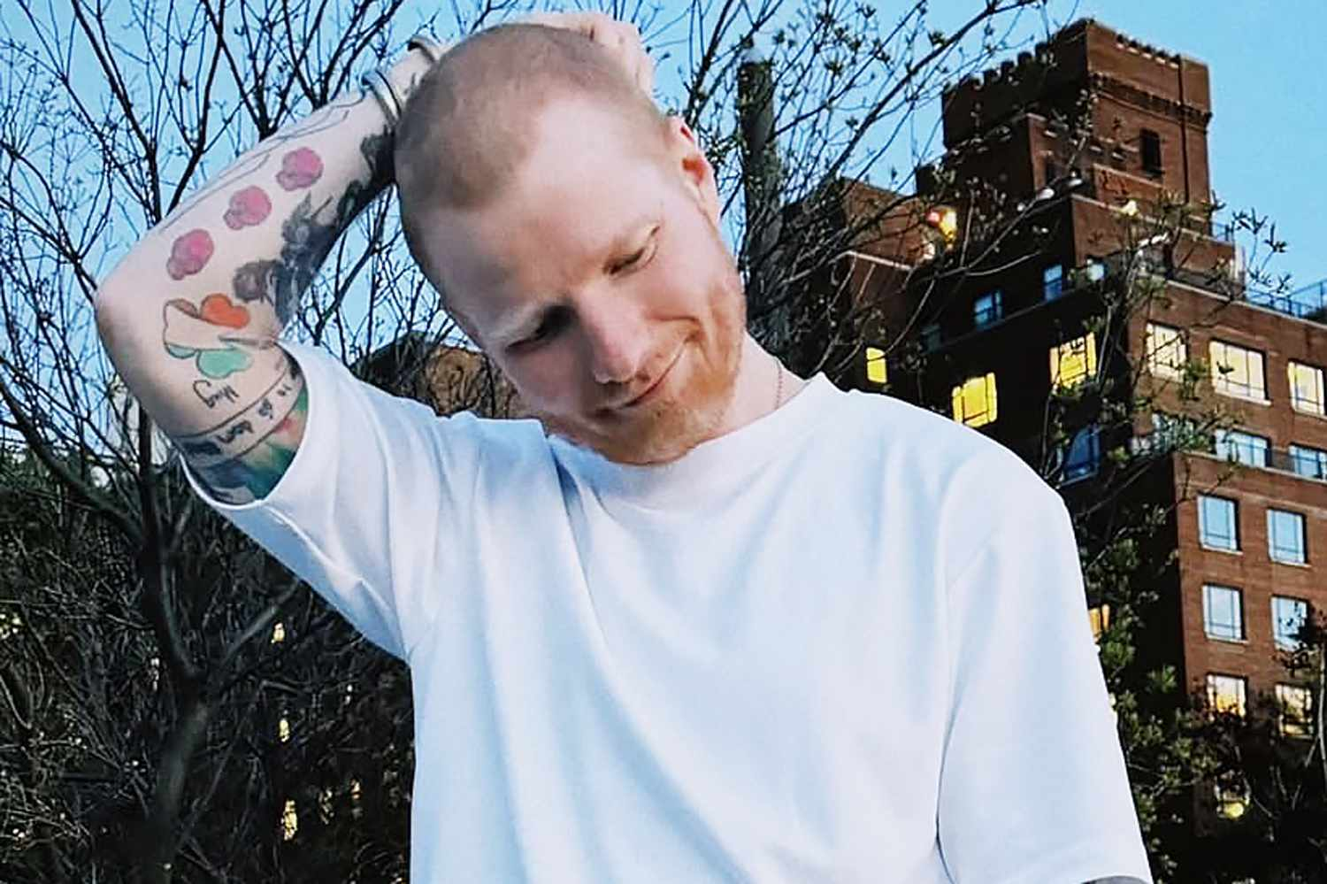Ed Sheeran Reveals He Had Shingles — and Why He Shaved His Head